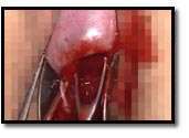 el cuello muy fuertemente extraído con el raspador agudo el cuello muy fuertemente extraído con el raspador agudo