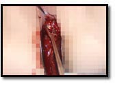 el raspador agudo extrae los intestinos el raspador agudo extrae los intestinos